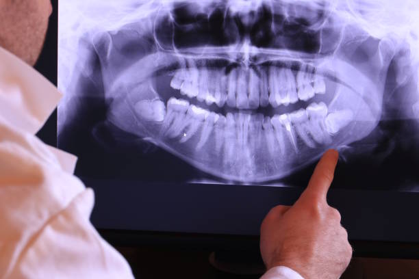 Best Emergency Dental Surgery in Walker Valley, NY